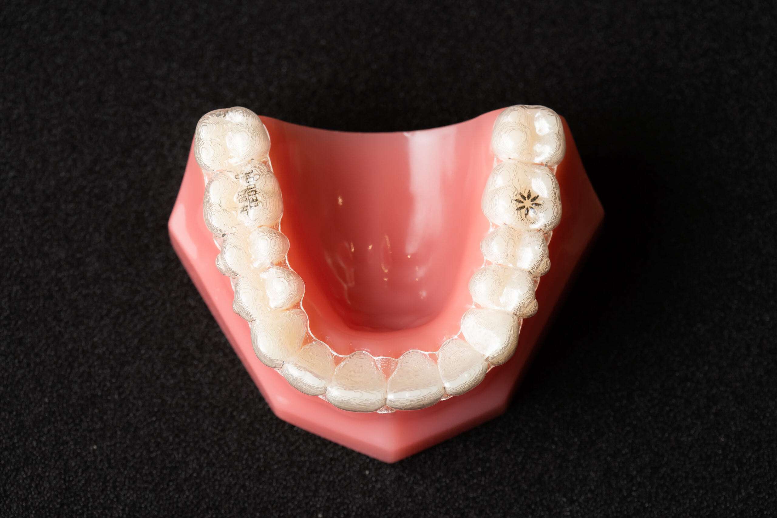 美しい歯並びを(*^-^*)