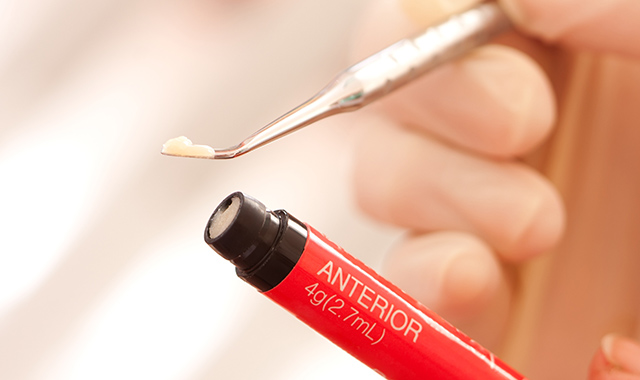 CR（コンポジットレジン）