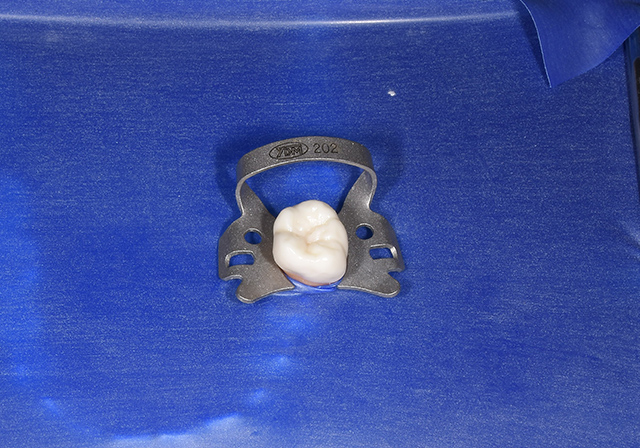 ラバーダム防湿