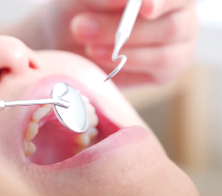 予防歯科の重要性