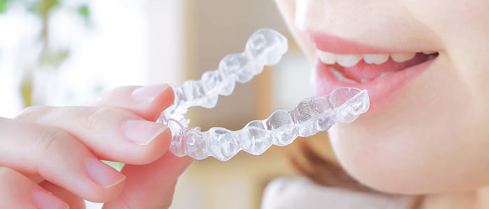 マウスピース矯正