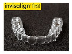 インビザラインファースト（小学生～）